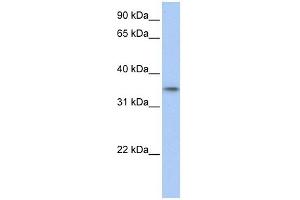 C17ORF39 antibody used at 1 ug/ml to detect target protein. (GID4 Antikörper  (C-Term))