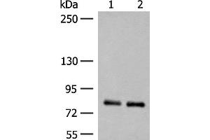 Western blot analysis of Rat brain tissue and Mouse brain tissue lysates using NGEF Polyclonal Antibody at dilution of 1:250 (NGEF Antikörper)