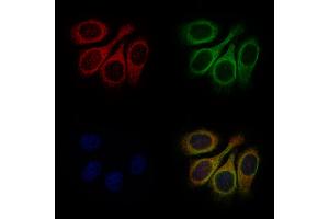 ABIN7093174 and ABIN7101256 staining Hela cells by IF/ICC. (C9 Antikörper)