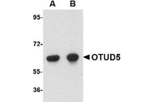 Western blot analysis of OTUD5 in human kidney lysate with OTUD5 antibody at (A) 1 and (B) 2 μg/ml. (OTUD5 Antikörper  (C-Term))