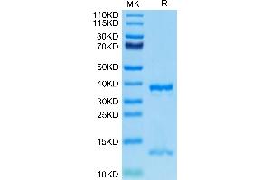 FcRn Protein (AA 24-297) (His tag)