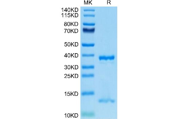 FcRn Protein (AA 24-297) (His tag)