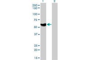 Western Blot analysis of ATP6AP1 expression in transfected 293T cell line by ATP6AP1 monoclonal antibody (M01), clone 3A2. (ATP6AP1 Antikörper  (AA 51-150))