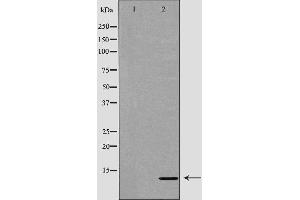 Western blot analysis of extracts of mouse cerebellum tissue, using FKBP1A antibody. (FKBP1A Antikörper  (N-Term))