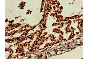 Immunohistochemistry of paraffin-embedded human lung tissue using ABIN7169773 at dilution of 1:100 (SKIL Antikörper  (AA 359-579))