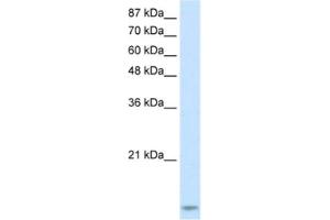 Western Blotting (WB) image for anti-TAR (HIV-1) RNA Binding Protein 2 (TARBP2) antibody (ABIN2462162) (TARBP2 Antikörper)