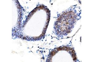 IHC analysis of METTL3 using anti-METTL3 antibody (ABIN7602366).