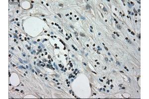 Image no. 4 for anti-Crystallin, alpha B (CRYAB) antibody (ABIN1497645) (CRYAB Antikörper)