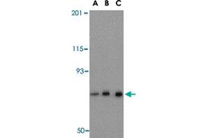 Western blot analysis of NCSTN in mouse brain tissue lysate with NCSTN polyclonal antibody  at (A) 0. (Nicastrin Antikörper  (C-Term))