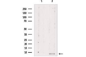 Western blot analysis of extracts from Mouse cancer, using RPL39 Antibody. (RPL39 Antikörper  (C-Term))