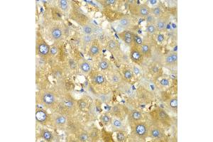 Immunohistochemistry of paraffin-embedded human liver injury using CHIA antibody (ABIN6292576) at dilution of 1:100 (40x lens).