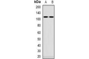 Western blot analysis of VPS54 expression in Jurkat (A), rat blood (B) whole cell lysates.