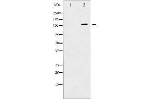 Western blot analysis of c-PLA2 expression in TNF-a treated HeLa whole cell lysates,The lane on the left is treated with the antigen-specific peptide. (PLA2G4A Antikörper  (Internal Region))