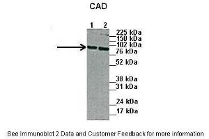 Lanes:   1. (CAD Antikörper  (N-Term))