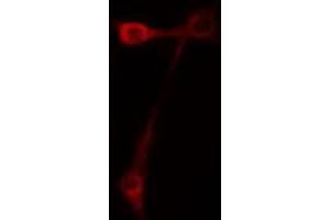 ABIN6267397 staining NIH-3T3 cells by IF/ICC. (CD44 Antikörper  (pSer706))