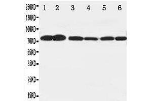 Anti-B Raf antibody, Western blotting Lane 1: Rat Brain Tissue Lysate Lane 2: Rat Testis Tissue Lysate Lane 3: Rat Liver Tissue Lysate Lane 4: SW620 Cell Lysate Lane 5: COLO320 Cell Lysate Lane 6: PC-12 Cell Lysate