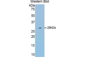 Western blot analysis of the recombinant protein. (Fascin Antikörper  (AA 27-273))