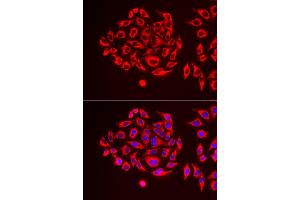 Immunofluorescence analysis of U2OS cells using TUFM antibody. (TUFM Antikörper)