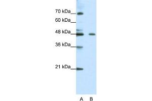 WB Suggested Anti-ZNF645 Antibody Titration:  0. (ZNF645 Antikörper  (N-Term))