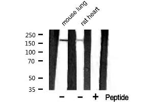 Western blot analysis of extracts of various celllines,using MAP2 antibody. (MAP2 Antikörper  (N-Term))