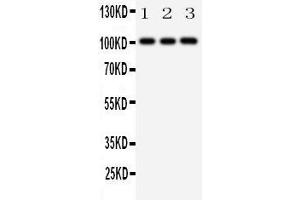 Anti-MCK10 antibody, Western blotting Lane 1: A431 Cell Lysate Lane 2: A549 Cell Lysate Lane 3: HELA Cell Lysate (DDR1 Antikörper  (C-Term))