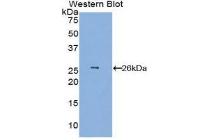 Western Blotting (WB) image for anti-Elastin Microfibril Interfacer 1 (EMILIN1) (AA 803-1016) antibody (ABIN1858712) (Emilin1 Antikörper  (AA 803-1016))
