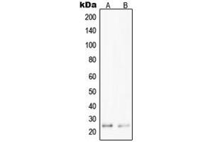 Western blot analysis of PPP1R14D expression in Jurkat (A), HepG2 (B) whole cell lysates. (PPP1R14D Antikörper  (Center))