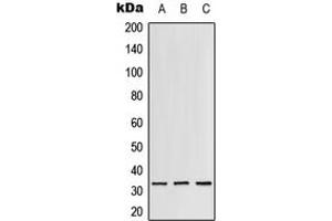 Western blot analysis of RPS3 expression in Jurkat (A), mouse liver (B), rat lung (C) whole cell lysates. (RPS3 Antikörper  (C-Term))