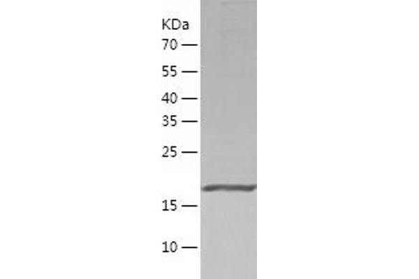 Peroxiredoxin 2 Protein (PRDX2) (AA 1-198) (His tag)