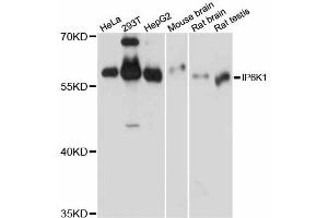 Western blot analysis of extracts of various cell lines, using IP6K1 antibody (ABIN6293094) at 1:1000 dilution. (IP6K1 Antikörper)