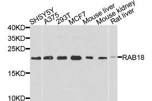 Western blot analysis of extracts of various cell lines, using RAB18 antibody (ABIN5971481) at 1/1000 dilution. (RAB18 Antikörper)