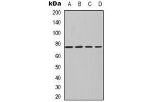 Western blot analysis of PKC iota/zeta expression in MCF7 (A), NIH3T3 (B), mouse kidney (C), rat kidney (D) whole cell lysates. (PKC iota/zeta Antikörper)