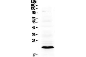 Western blot analysis of Bcl-2 using anti-Bcl-2 antibody . (BID Antikörper  (AA 1-195))