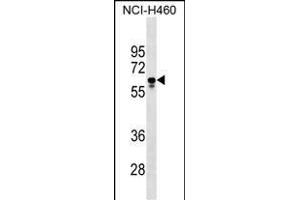 PGS1 Antibody (Center) (ABIN1538219 and ABIN2849280) western blot analysis in NCI- cell line lysates (35 μg/lane). (PGS1 Antikörper  (AA 272-299))