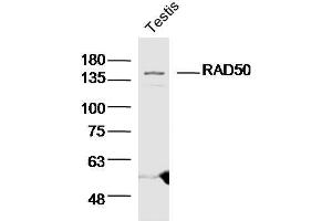 Mouse testis lysates probed with RAD50 Polyclonal Antibody  at 1:300 overnight at 4°C followed by a conjugated secondary antibody for 60 minutes at 37°C. (RAD50 Antikörper  (AA 817-872))