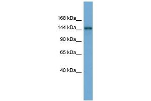 WB Suggested Anti-TEX14 Antibody Titration: 0. (TEX14 Antikörper  (Middle Region))