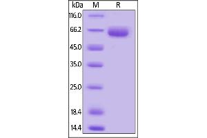 SDS-PAGE (SDS) image for SLAM Family Member 7 (SLAMF7) (AA 22-224) protein (Fc Tag) (ABIN6253645)