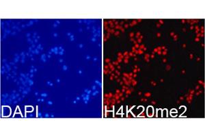 Immunofluorescence analysis of 293T cells using Dimethyl-Histone H4-K20 antibody (ABIN5969818).