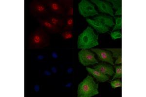 ABIN7093617 and ABIN7097642 staining  cells by IF/ICC. (MAPK8IP1 Antikörper)