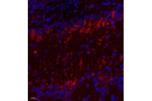 Immunofluorescence of paraffin embedded mouse prefrontal lobe using TTC33 (ABIN7075871) at dilution of 1: 650 (400x lens) (TTC33 Antikörper)