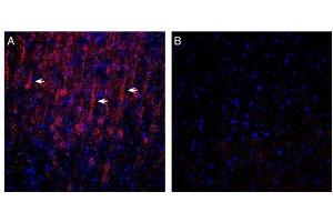Expression of GPR183 in in rat parietal cortex. (GPR183 Antikörper  (Extracellular))