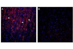Expression of GPR183 in in rat parietal cortex. (GPR183 Antikörper  (Extracellular, N-Term))