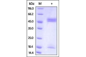 SDS-PAGE (SDS) image for neonatal Fc Receptor (FcRn) (AA 22-297) protein (His tag,Strep Tag) (ABIN2870741)
