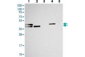 Western blot analysis of Lane 1: RT-4, Lane 2: U-251 MG, Lane 3: Human Plasma, Lane 4: Liver, Lane 5: Tonsil with CHID1 polyclonal antibody . (CHID1 Antikörper)