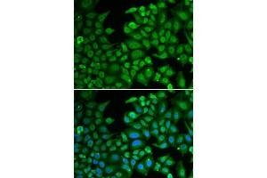 Immunofluorescence analysis of MCF-7 cells using RBFOX3 antibody (ABIN5970347). (NeuN Antikörper)