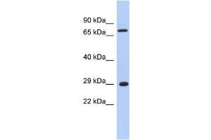 Human Muscle; WB Suggested Anti-AKTIP Antibody Titration: 0.