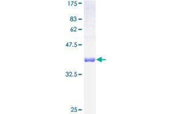 TIMM10B Protein (AA 1-103) (GST tag)