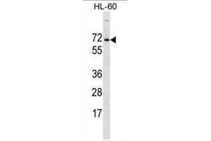 ACPL2 Antibody (Center) western blot analysis in HL-60 cell line lysates (35 µg/lane). (ACPL2 Antikörper  (Middle Region))