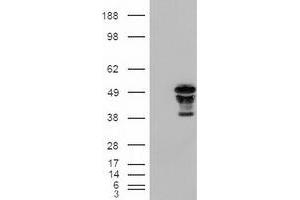 Western Blotting (WB) image for anti-Forkhead Box A2 (FOXA2) (AA 300-458) antibody (ABIN1491367) (FOXA2 Antikörper  (AA 300-458))