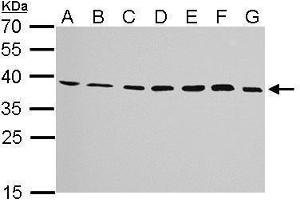 WB Image JAM-B antibody detects JAM2 protein by Western blot analysis. (JAM2 Antikörper)